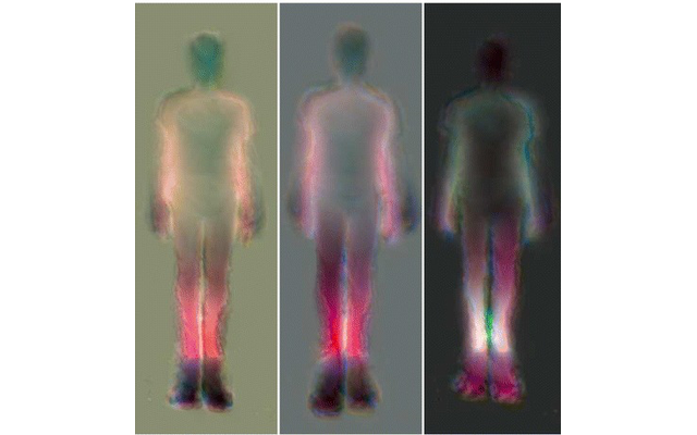 Gait asymmetry maps, figure 7 of the paper (CC BY 4.0)